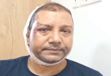 मुझे घेरा गया और हमला किया, उनके पास लाठियां और पत्थर थे : इंस्पेक्टर नंद किशोर सिंह Inspector Nand Kishore Statement he got attacked badly